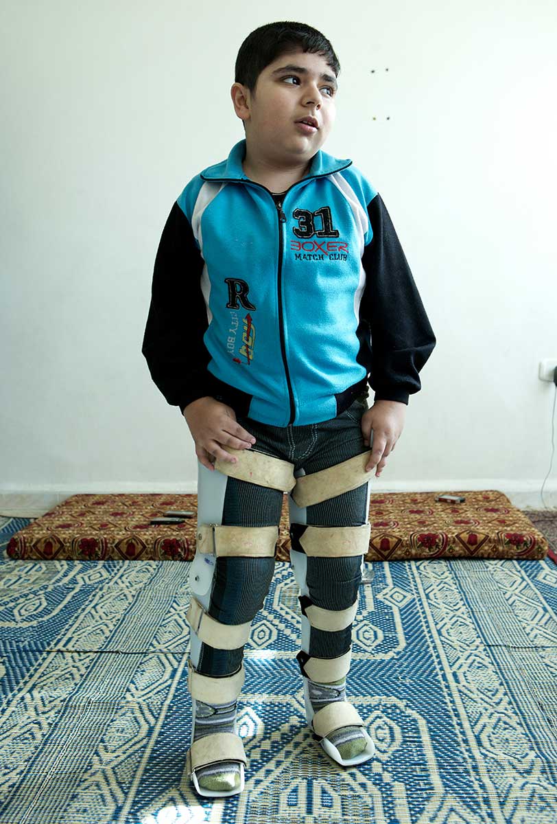 Bashar was hit by shrapnel from a bomb blast while fleeing the fighting in Syria with his family. His left leg was shattered. Already suffering from childhood arthrithis, he didn't get medical care soon enough and his legs got weaker from lack of use. Our team in Jordan found him in desperate need of rehabilitation and took action to stop his condition deteriorating further. His recovery was painful and slow, but his family helped him do his exercises every day. Finally he could stand again with orthotic supports - his first step to walking again unaided. © Giles Duley/Handicap International